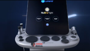 Lumenis NuEra Tight Laser 1 Lumenis NuEra Tight Laser with FocalRF Technology