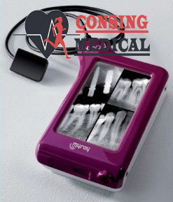 MyRay WDS X-pod sensor size 2 x-ray