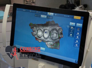 New Sirona Apollo DI Intra Oral 2 Sirona Apollo DI Intra Oral Scanner