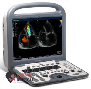 New SonoScape S8 Portable Ultrasound 1 SonoScape S8 Portable Ultrasound