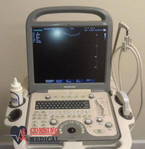 New SonoScape S8 Portable Ultrasound 3 SonoScape S8 Portable Ultrasound