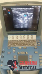 SonoSite MicroMaxx Ultrasound Machine