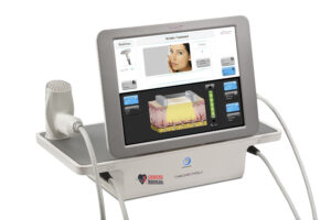 Sale - Syneron Candela eTwo Laser 1 Syneron Candela eTwo Laser